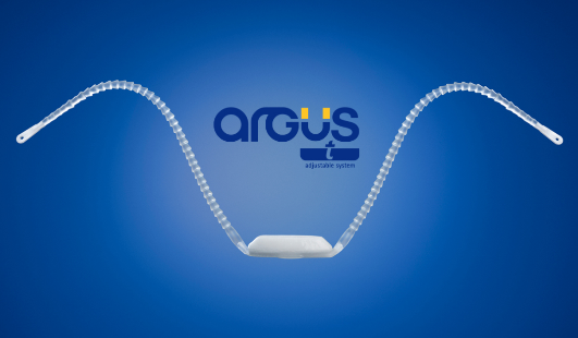 Arcus T Product Release